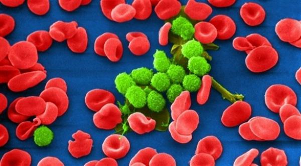 تقنية زراعة للخلايا تمنح مرضى سرطان الدم أملاً جديداً