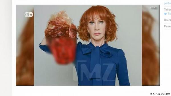 سي.إن.إن تنهي تعاقدها مع كوميدية بسبب "رأس شبيهة برأس ترامب"