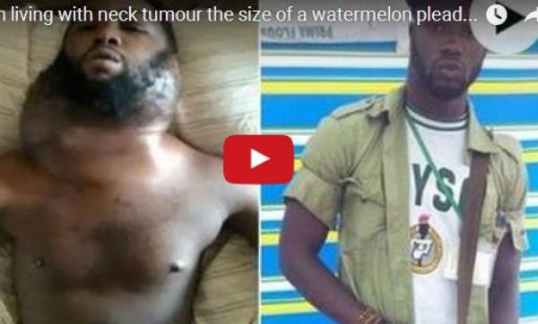 بالفيديو: شاب يعيش مع كتلة بحجم بطيخة في عنقه