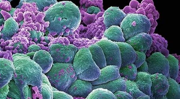 الأطباء يستخدمون الفيروسات الغدية في محاربة السرطان