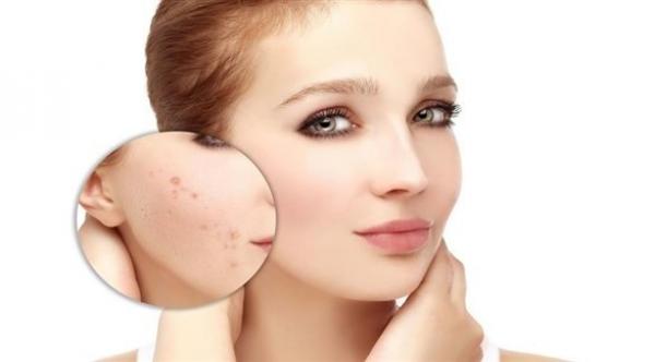 مشاهير التواصل الاجتماعي سبب زيادة مرضى "الجلدية"