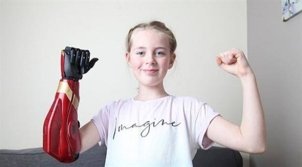 تلميذة بريطانية تحصل على أول ذراع ربووتي بقيمة 5000 دولار