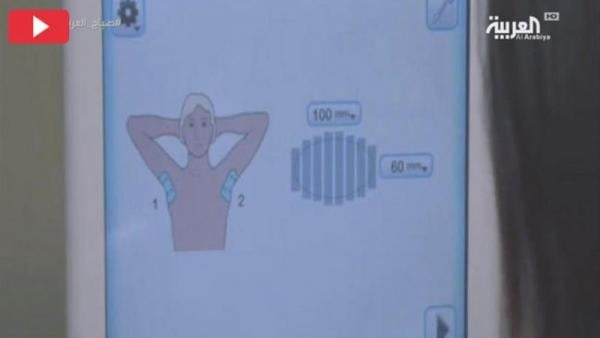 تقنية جديدة تعالج مشكلة التعرق الزائد بشكل دائم