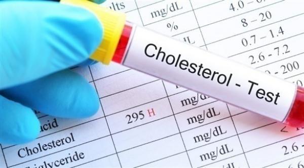 متى يوصى بفحص الكولسترول؟
