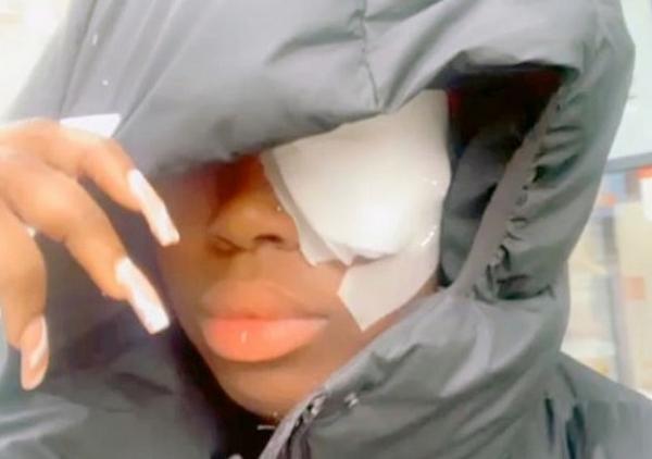 انفجار شاحن هاتفها يصيب طالبة جامعية بريطانية بأضرار بليغة في عينها