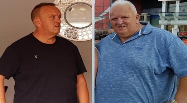 يستعيد شعره عبر فقدان الوزن