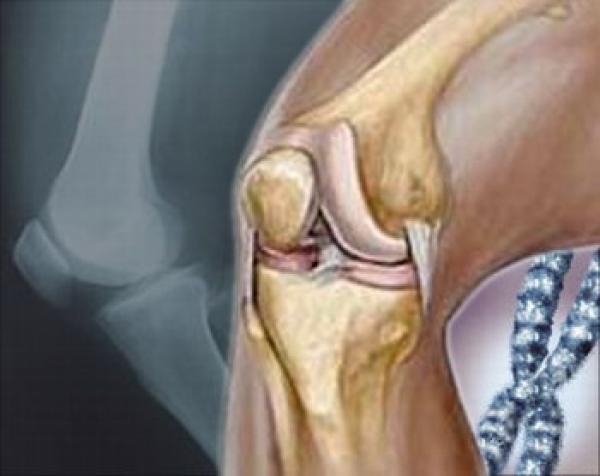 الرياضة تكافح هشاشة العظام