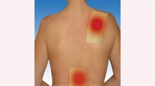 نصائح لإزالة اللصقات الطبية من على الظهر دون ألم