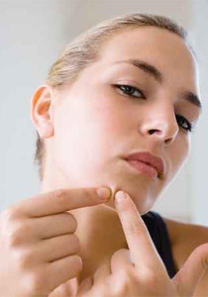 تجنب الرؤوس السوداء أصبح سهلا