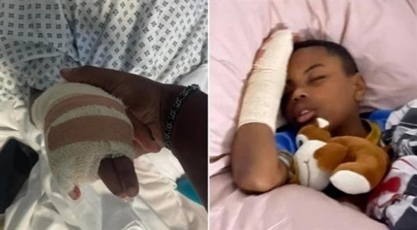 بُتر إصبعه أثناء هروبه من مجموعة من التلاميذ المتنمرين العنصريين