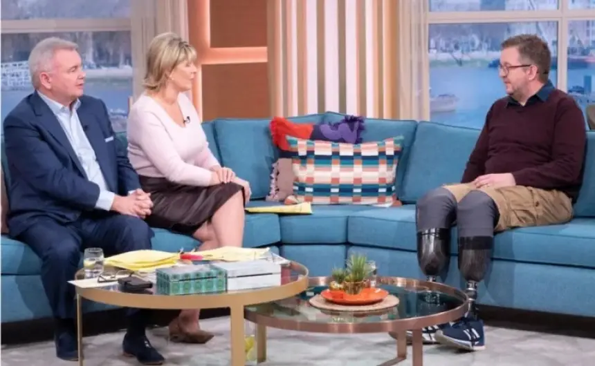 اتهام جراح بريطاني بقطع ساقيه عمداً للاحتيال على شركات التأمين