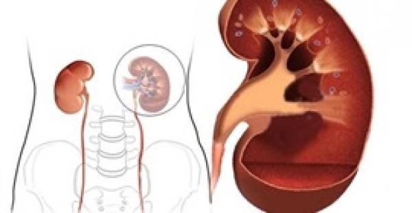 5 نصائح لأصحاب الكلية الواحدة يجب اتباعها