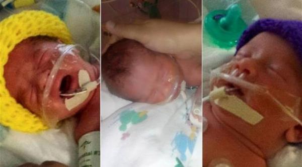  أب يصف ولادة أطفاله التوائم الثلاثة المتطابقين في ولاية تكساس بــ "المعجزة" (دايلي ميل) 