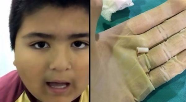 بالفيديو: طفل يصدر صوتاً غريباً عندما يتنفس بعدما ابتلع صفارة