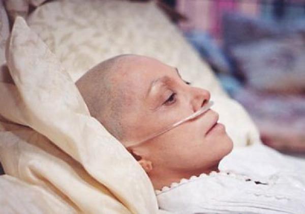 مريض بالسرطان - ارشيفية