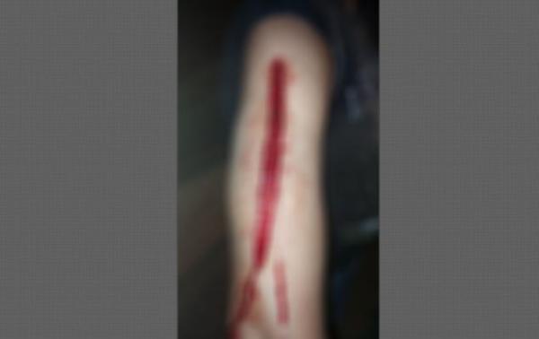 شرملة ذراع مراقب حافلة بفاس بالزيزوار