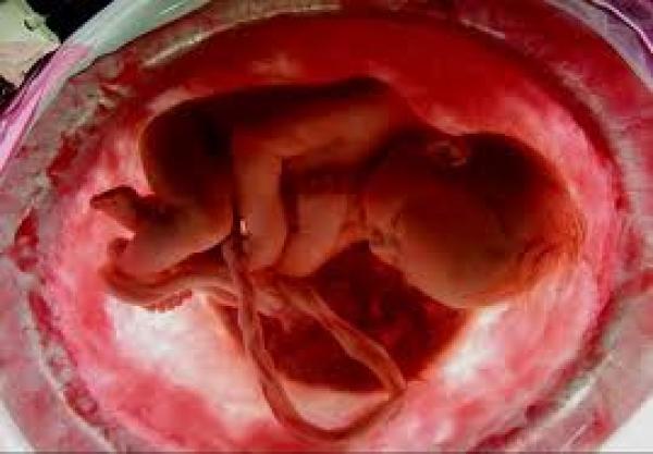 أول خصية صناعية تتيح للرجال المصابين بالعقم الإنجاب 