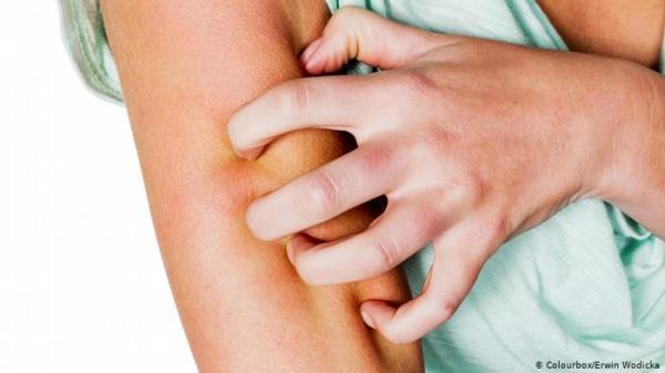 تحذير من "كوفيد-19": هذا الألم في الجلد لا ينبغي تجاهله