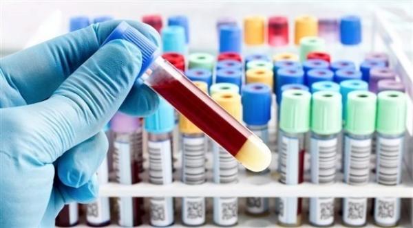 فحوصات للبول والدم يمكنها التنبأ بإمكانية الإصابة بالسرطان قبل 5 أعوام