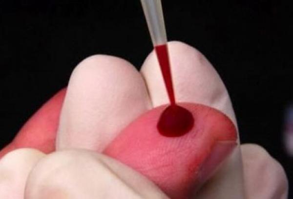 الأمم المتحدة تدعو إلى تعزيز الجهود للجم وباء الإيدز بحلول العام 2030