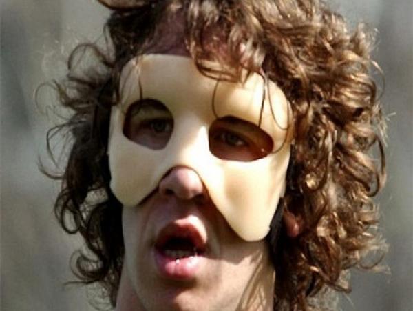 بويول يشارك في الكلاسيكو بقناع وجه