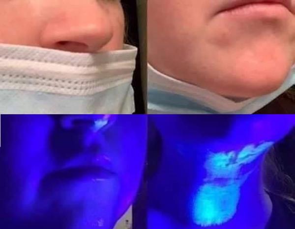 عالم فيروسات: وضع الكمامات بشكل خاطئ يحولها إلى بؤرة جراثيم