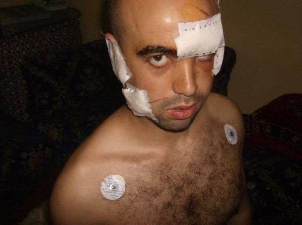 إبن عائلة نافذة بخنيفرة يطعن مواطنا طعنات قاتلة 