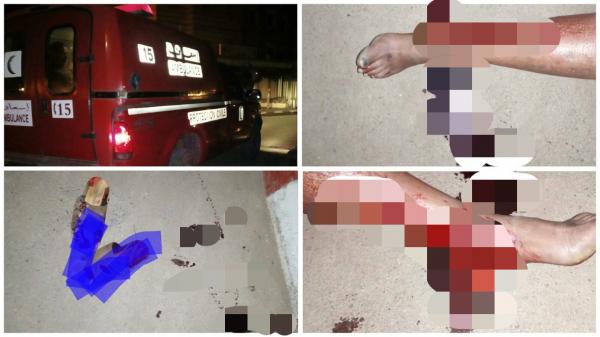 خطير... كلب شرس ينهش جسد مواطن بالشارع ويرسله في حالة حرجة للمستعجلات