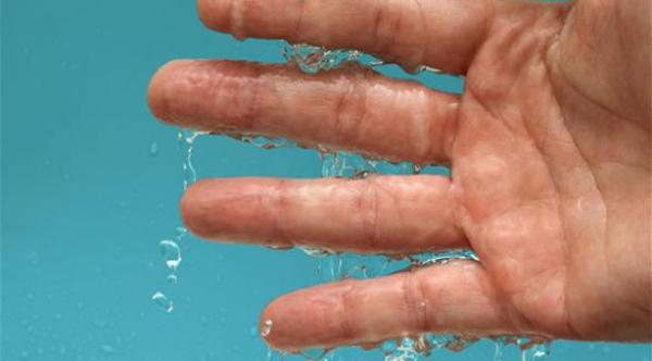 علاجات طبيعية لتعرّق اليدين المفرط