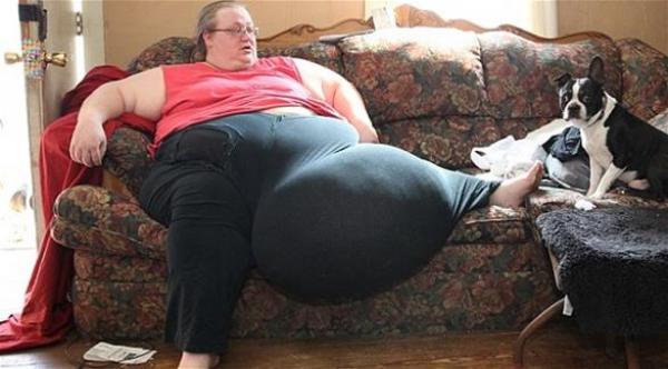  إزالة كتلة ضخمة وزنها 50 كيلو من بطن سيدة أمريكية (دايلي ميل) 