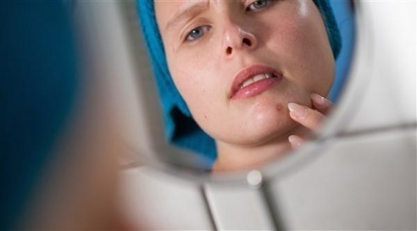 هذه الأغذية تهدد بشرتك بالبثور