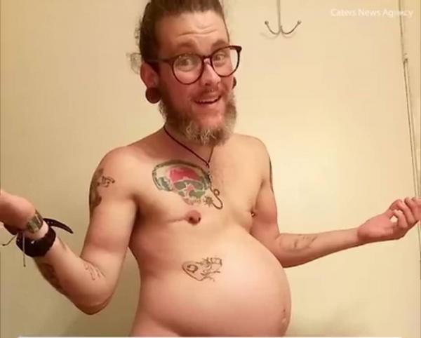 بالفيديو.. ما قصة الرجل الذي حير الأطباء بانجاب مولود من رفيقه؟