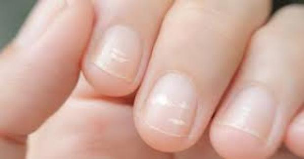 علامات خفية على أظافرك قد تعني أنك مصاب بـداء السكري"