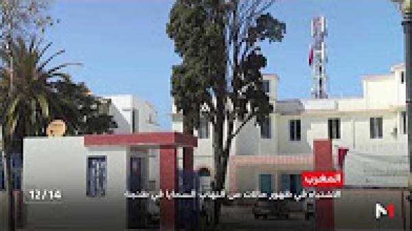 الاشتباه في ظهور حالات لمرض إلتهاب السحايا في طنجة