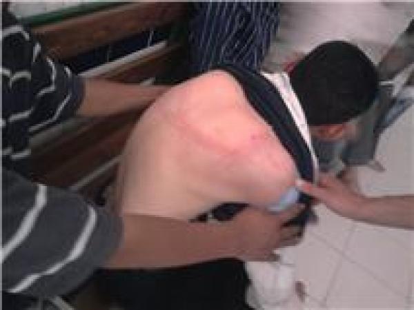 أبناء بنكيران و محمد يتيم بالسمارة    يستنكران التدخل الهمجي في حق شباب ساكنة مخيمات الوحدة