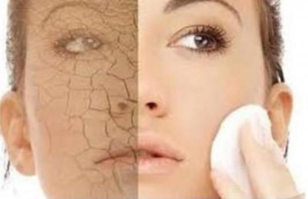 جفاف البشرة في رمضان وكيفية التخلص منه