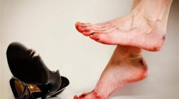 الكعب العالي يهدد المرأة بهشاشة العظام