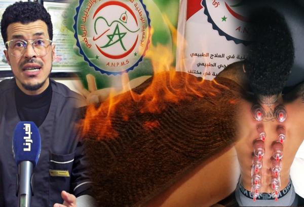 بالفيديو: "الشقروني" يتحدث عن أحدث تقنيات "الحجامة" وأكثرها انتشارا عبر العالم ويحذر من "ممارسات" غير قانونية
