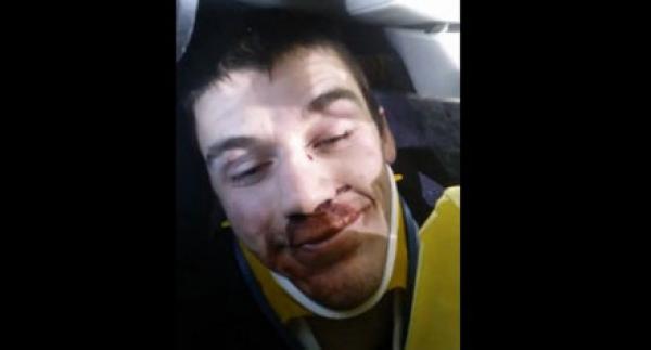 سائق سيارة يلتقط فيديو لنفسه بعد وقوعه في حادث