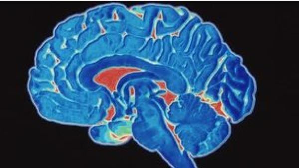 خلايا العين يمكن أن تساعد في تشخيص مرض الزهايمر