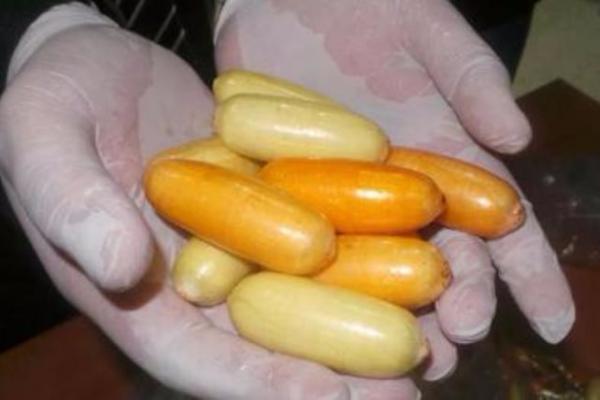 استخراج كمية من المخدرات من أمعاء مواطن تونسي بمطار محمد الخامس