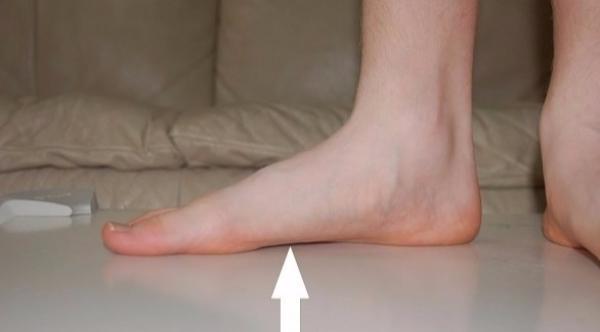 توصية بعدم الاستهانة بآلام باطن القدم والذهاب إلى الطبيب