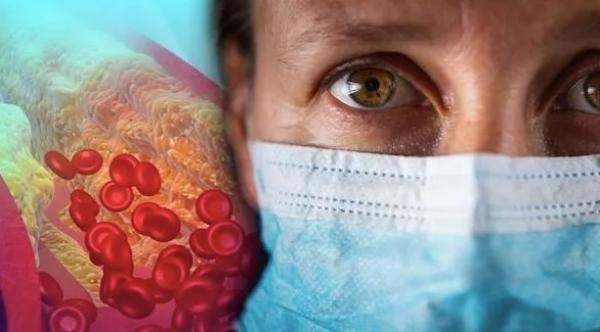 الكوليسترول التي يحمله الشخص قد يكون العامل الرئيسي في اختلاف  شدة عدوى كورونا