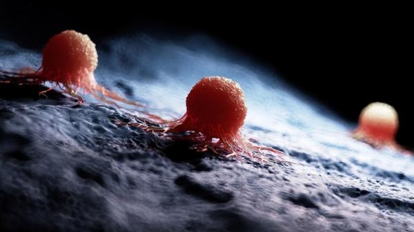 داء شائع الانتشار يزيد من خطر الإصابة بأي نوع من السرطان