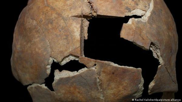 اكتشاف عملية جراحة في الجمجمة أُجريت قبل ثلاثة آلاف سنة