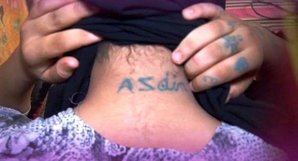 أخيرا...تطور حاسم في قضية فتاة "الوشم" خديجة