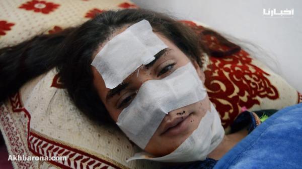 شابة تطوانية تستنجد بالدكتور التازي والمحسنين بعد تشوه وجهها في حادثة سير