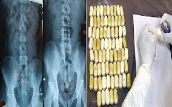 ها شحال لقاو ديال الكوكايين داخل أمعاء 4 أفارقة بالبيضاء