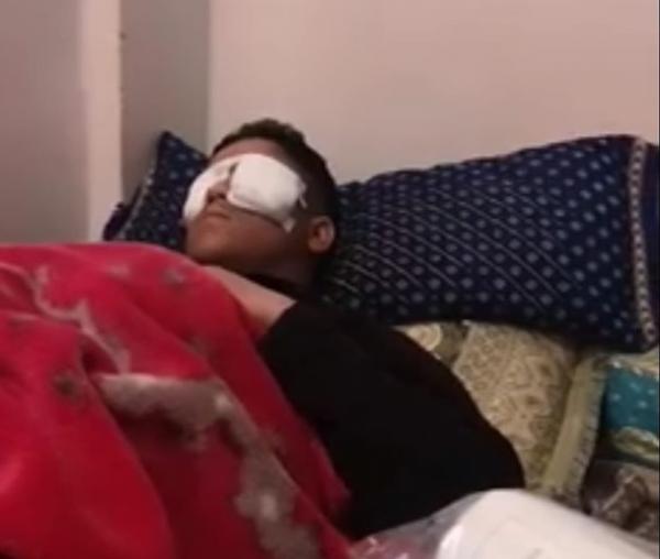 انفجار بطارية هاتف في وجه تلميذ يتابع دراسته عن بعد ووزارة أمزازي تدخل على الخط (فيديو)