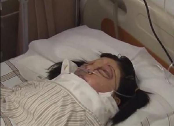  زرع وجه جديد لفتاة صينية في صدرها